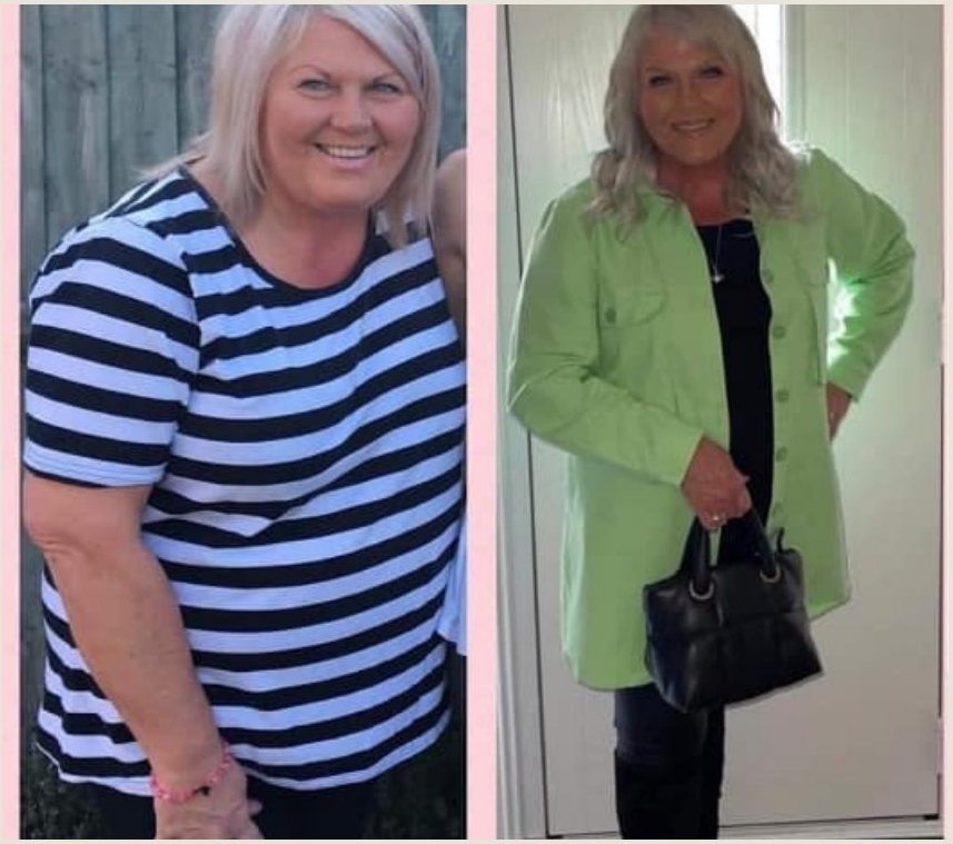 Voor en na Body Reset, lachende vrouw in gestreept shirt en groene jas