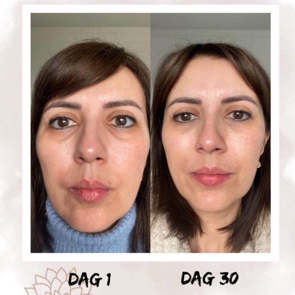 Voor en na Collagen Elixir™, gezicht van een vrouw op dag 1 en dag 30