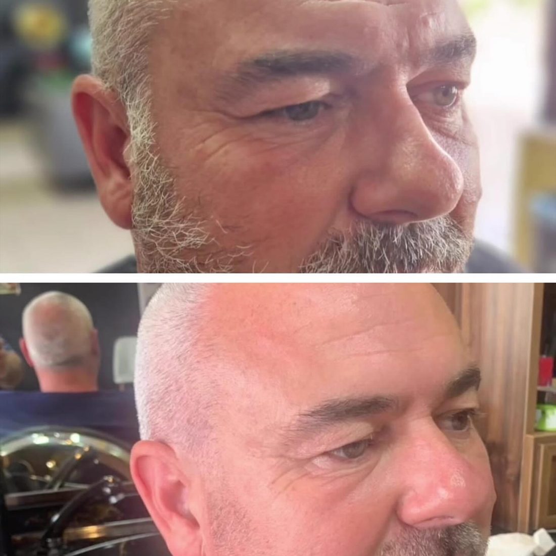 Voor en na Collagen Elixir™, gezicht van een man met grijs haar