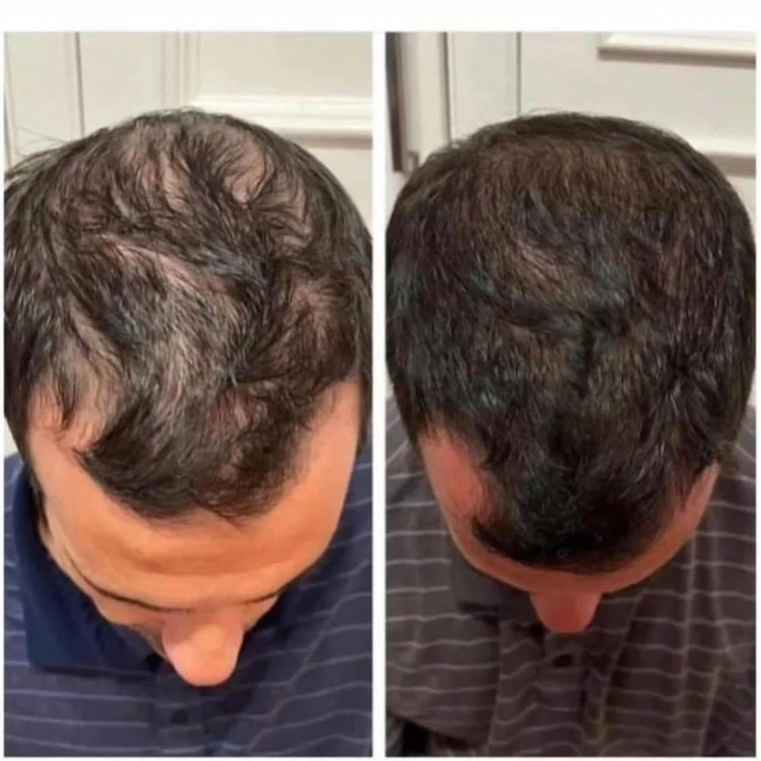 Voor en na Collagen Elixir™, haar van een man van bovenaf